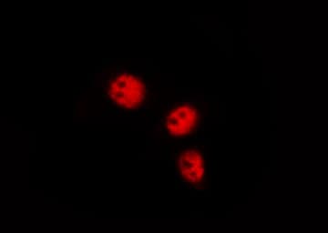 FOXO1 / FKHR Antibody (phospho-Ser329)