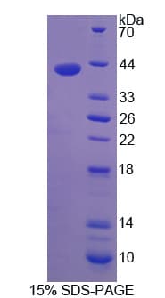 Human PTAR2 / FNTA Protein (Recombinant His-T7)