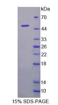 Human AHRR / AhR Repressor Protein (Recombinant)