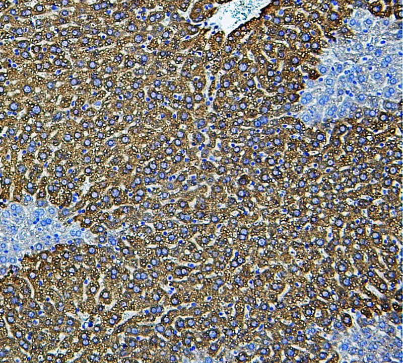 CYP2E1 Antibody (aa94-112)