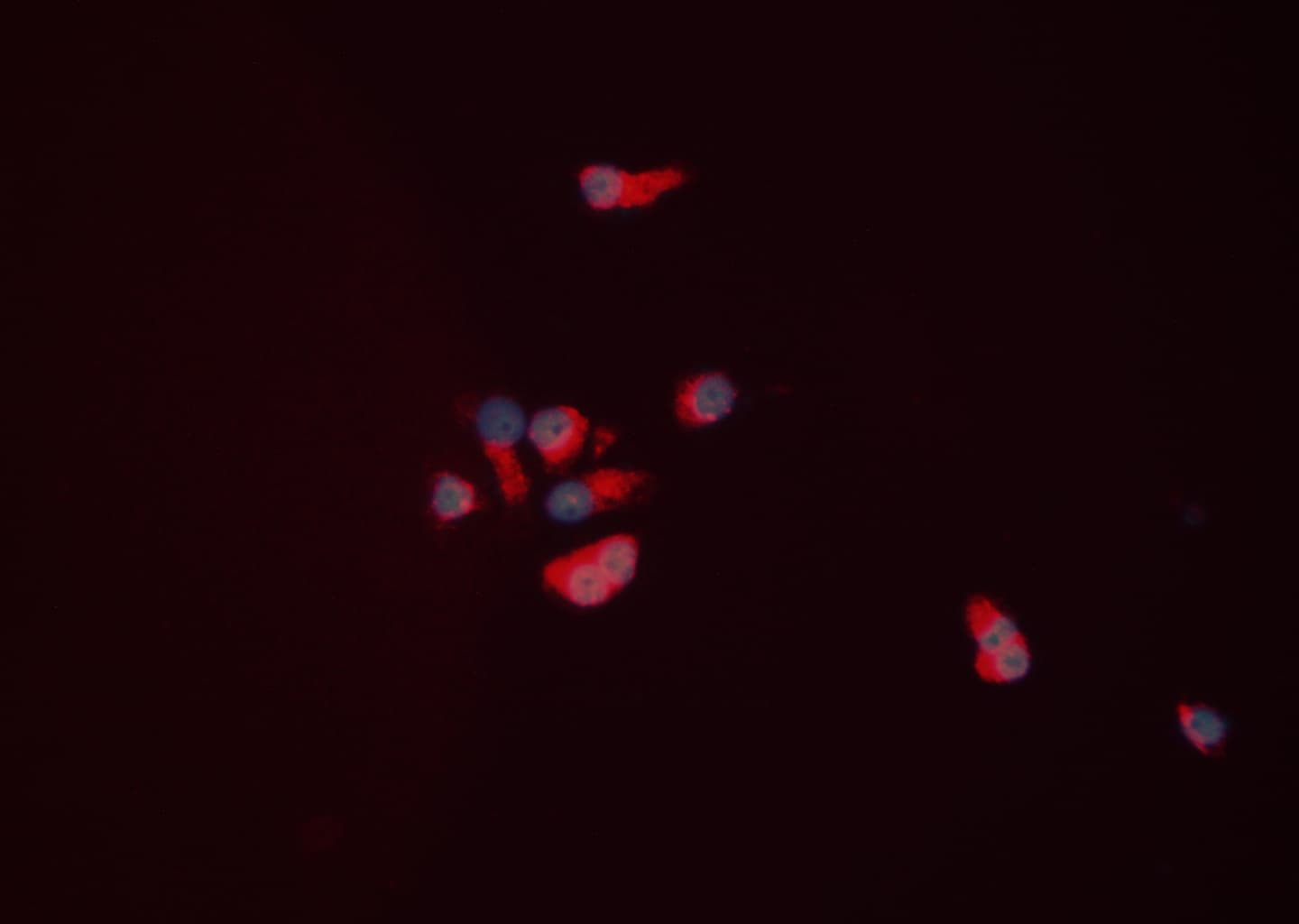 Polyclonal Rabbit anti-Human NPY5R Antibody (IHC, IF, WB)