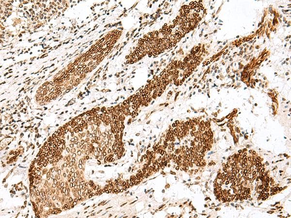 Polyclonal Rabbit anti-Human FANCB / FAB Antibody (IHC)