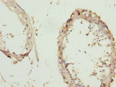 ZNF264 Antibody