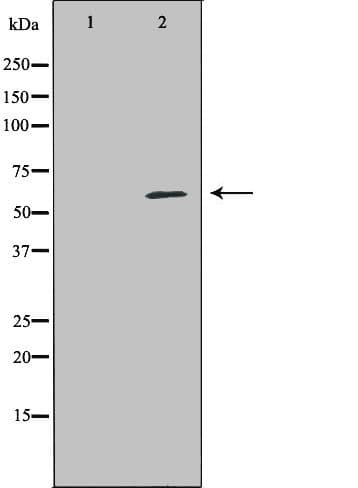PRF1 / Perforin Antibody