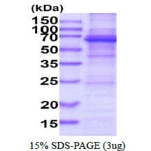 Human DDX56 Protein (Recombinant His)