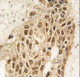 DNMT3A Antibody (aa31-61)