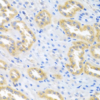 BMP3 Antibody