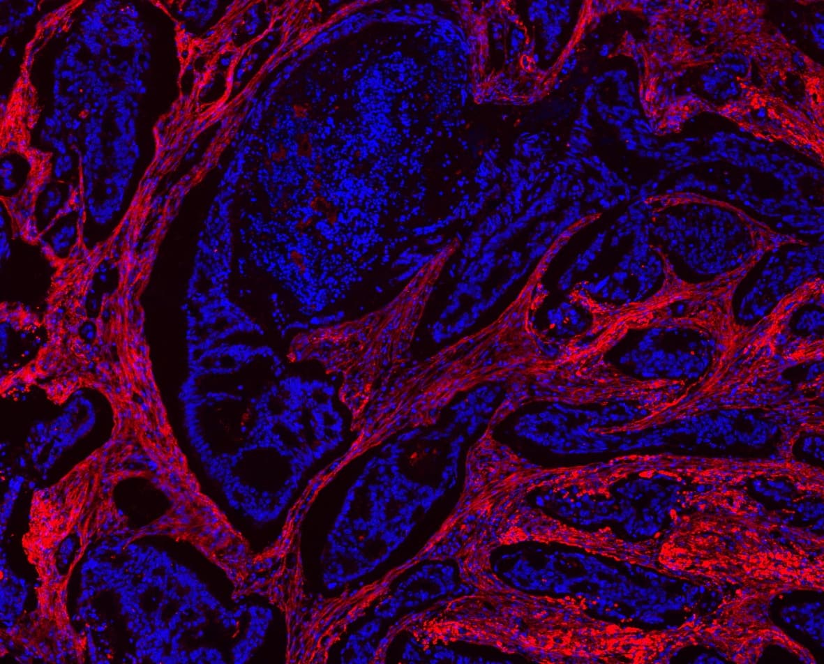 COL1A1 / Collagen I Alpha 1 Antibody (aa1192-1207)