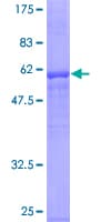 Human NMNAT2 Protein (Recombinant GST)
