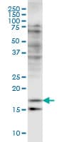 CFL2 / Cofilin 2 Antibody (clone 6G9)