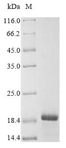 Human ADAMTS18 Protein (Recombinant 6His, N-terminus)