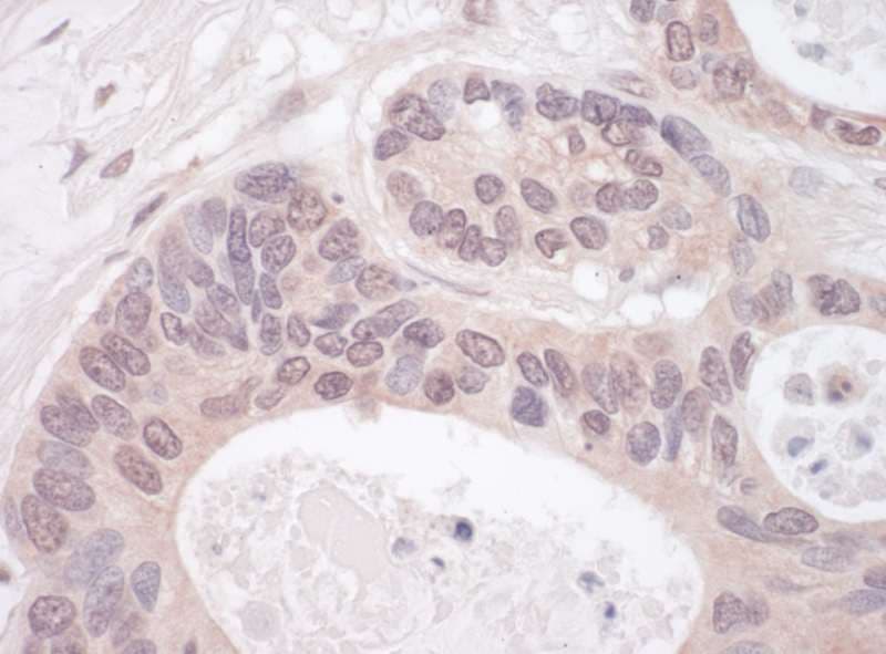 RNGTT / HCAP Antibody (aa1-50)