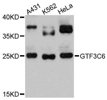 Polyclonal Rabbit anti-Human GTF3C6 Antibody (WB)