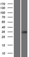 ATOH8 Protein (Over-Expression Lysate Myc-DDK (Flag))