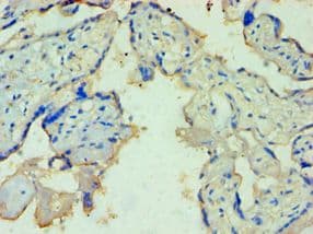 TDP1 Antibody (aa1-260)