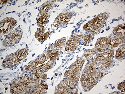 SYNE1 / Nesprin 1 Antibody (aa1-285, clone OTI1E10)