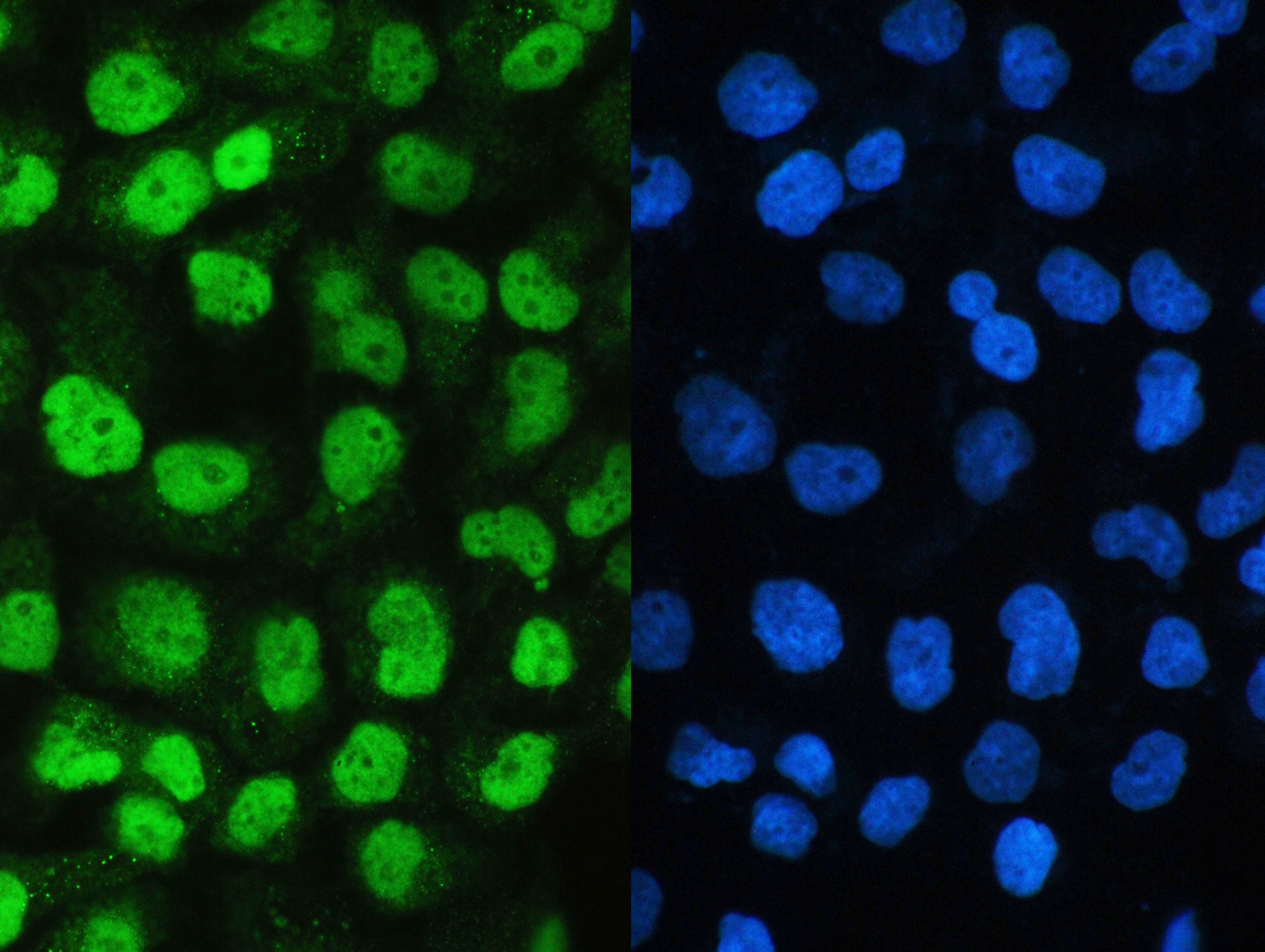 SAE2 / UBA2 Antibody