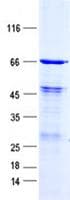 Human FBXW8 Protein (Recombinant His, N-Terminal)