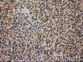 CTNNB1 / Beta Catenin Antibody (clone OTI1B11)