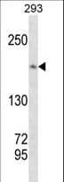 TOP2A / Topoisomerase II Alpha Antibody
