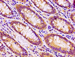 Polyclonal Rabbit anti-Human SNAP23 / SNAP-23 Antibody (IHC)