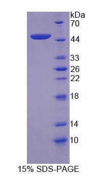 Human Complement C8g Protein (Recombinant His-GST)