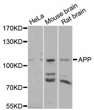 APP / Beta Amyloid Precursor Antibody