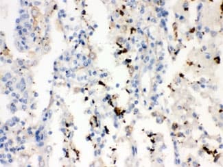 Polyclonal Rabbit anti-Human SFTPA1 + SFTPA2 Antibody (IHC, WB)