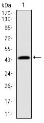 IHC-plus™ PBK / TOPK Antibody (clone 2C8)