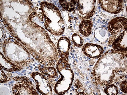 Monoclonal Mouse anti-Human CYP7B1 Antibody (clone OTI1G7, aa263-506, IHC, WB)