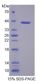Human MTHFR Protein (Recombinant His)