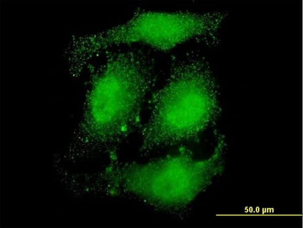 DRPLA / Atrophin-1 Antibody (clone 2C10)