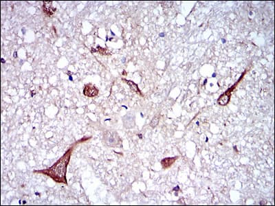Monoclonal Mouse anti-Human NF-L / NEFL Antibody (clone 2G10, IHC, IF, WB)