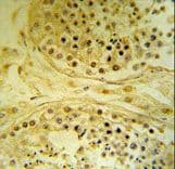 IMP4 Antibody (aa215-243)