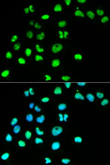 Polyclonal Rabbit anti-Human MSH6 Antibody (IHC, IF, WB)