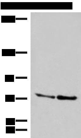 Polyclonal Rabbit anti-Human DNAJC14 Antibody (IHC, WB)