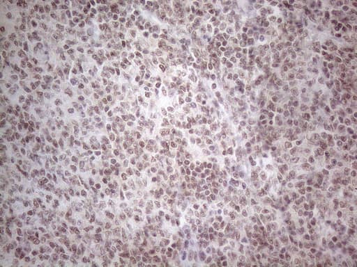 NR2C2 / TAK1 Antibody (aa1-241, clone OTI4B1)