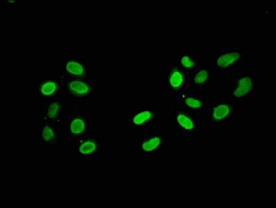 HIST1H2AI Antibody