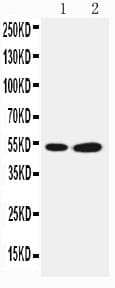 Selenium Binding Protein 1 Antibody (aa226-240)