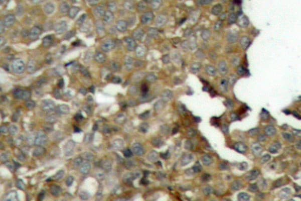 CFL1 / Cofilin Antibody (Met1)