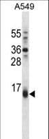 BBC3 / PUMA Antibody (aa109-137)