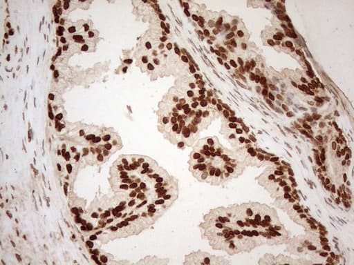 Monoclonal Mouse anti-Human ALOX5 / 5-LOX Antibody (clone OTI3F1, aa18-364, IHC, WB)