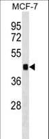 IER5 Antibody (aa122-149)