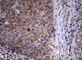 Monoclonal Mouse anti-Human CTNND1 / p120 Catenin Antibody (clone OTI3G1, IHC, WB)