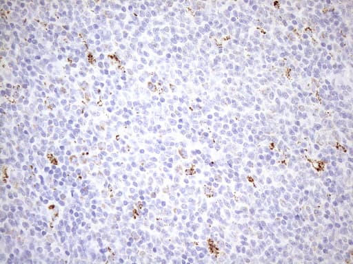 PPIF / Cyclophilin F Antibody (clone OTI1G8)