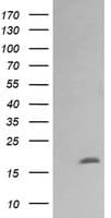 CTAG1B / NY-ESO-1 Antibody (clone OTI4B11, Carrier-free)