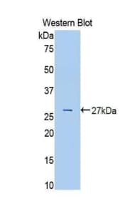 TF / Transferrin Antibody (aa380-565)