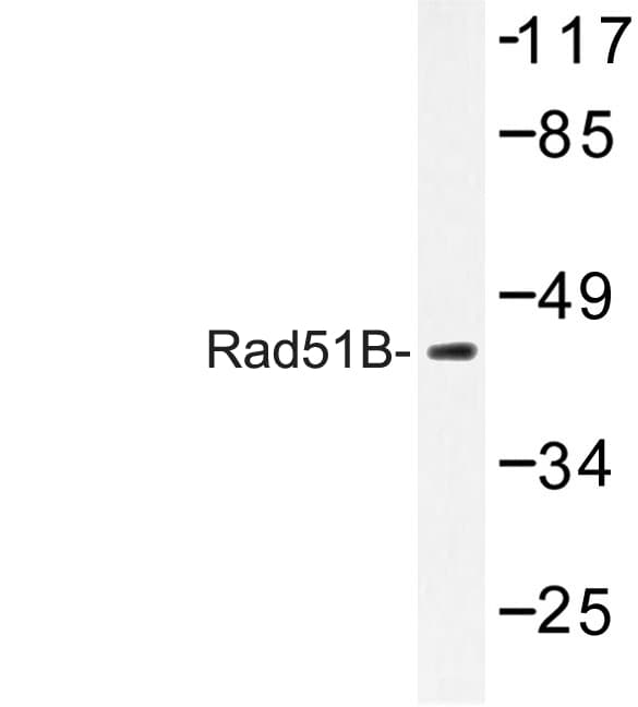 RAD51B Antibody (Gly226)