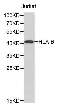 IHC-plus™ HLA-B Antibody