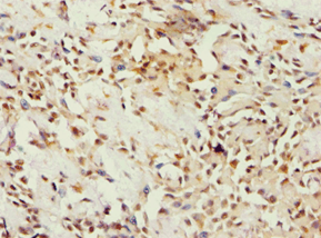 BCKDK Antibody (aa153-412)